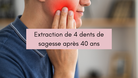 Lire la suite à propos de l’article Extraction de 4 dents de sagesse après 40 ans